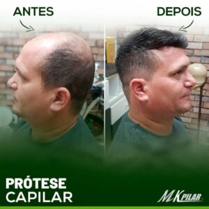 Mkpilar 7