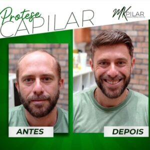 Mkpilar 9