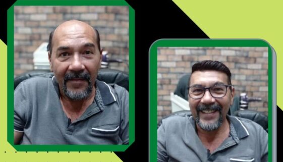 porque usar uma protese capilar